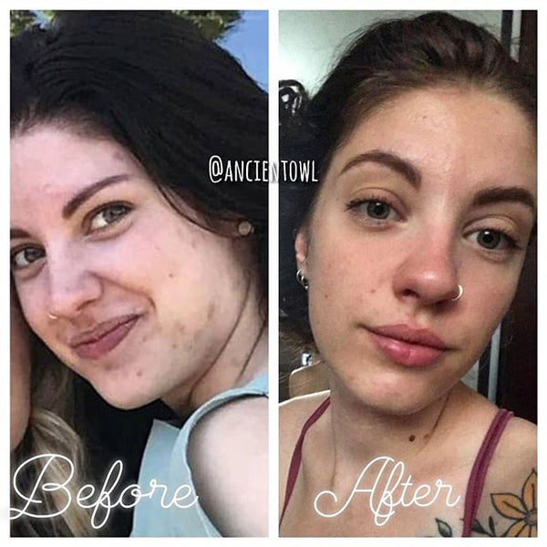 Huge life changer to heal your skin